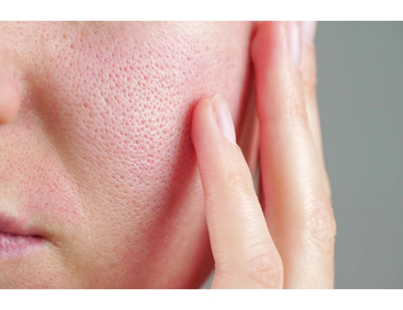 Закупоренные поры – причины, методы борьбы с ними